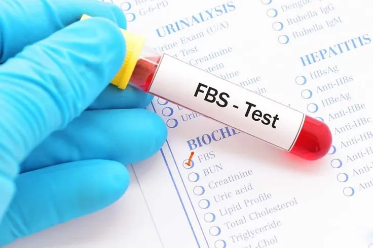 Blood Sugar Test