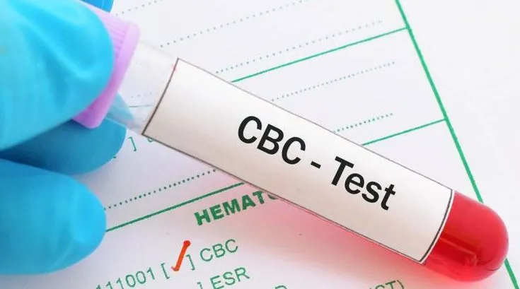 CBC