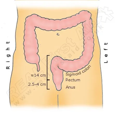 Treatment for Rectal Disorders (Without Surgery)