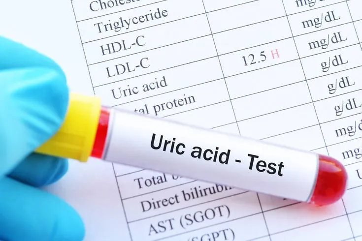 Uric Acid Test